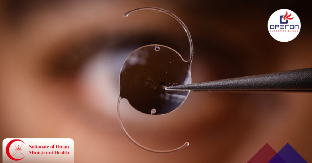 IOL Cast Molding Technology