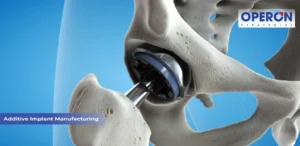 Additive Implant Manufacturing