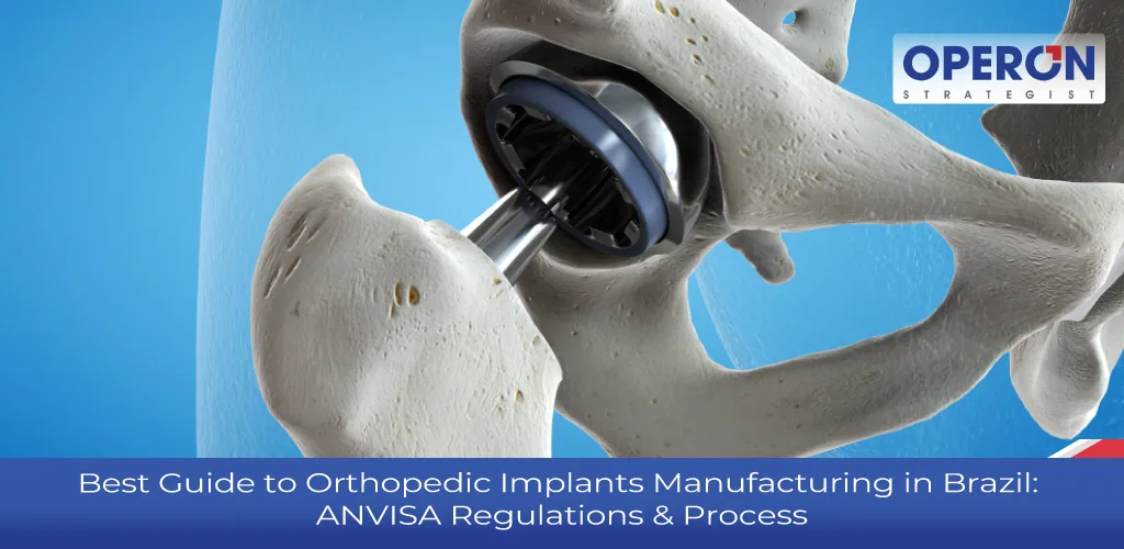 Orthopedic Implants Manufacturing