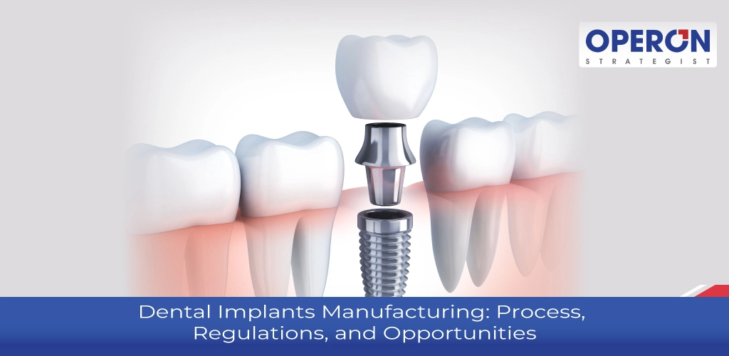 Dental Implants Manufacturing